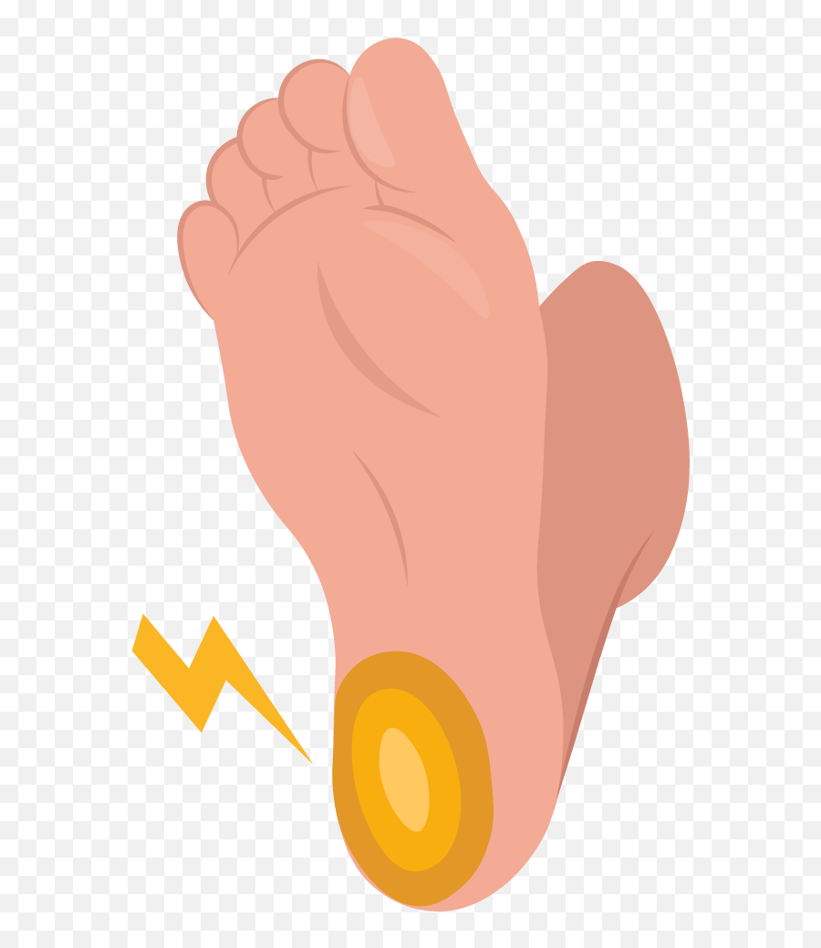 Heel Pain How To Get Rid Of 9 Causes U0026 Prevention - Language Png,Heel Icon