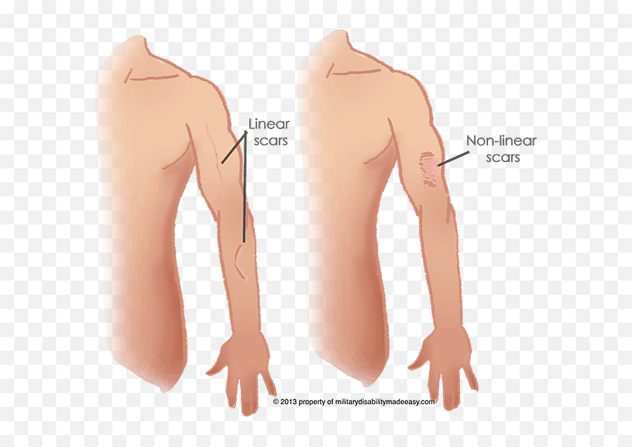 Index Of Png Scars