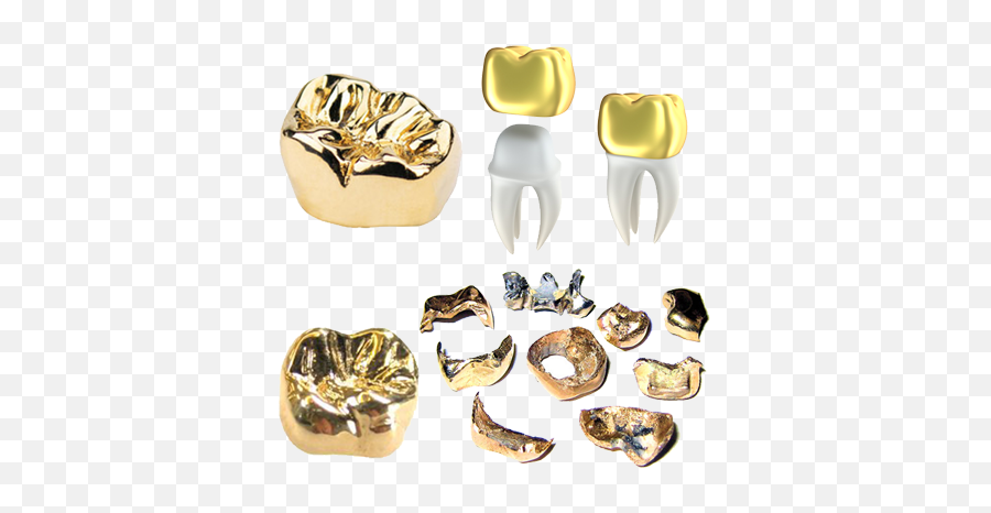 Gold Teeth Caps We Buy Salem - Gold Crown Tooth Png,Gold Teeth Png