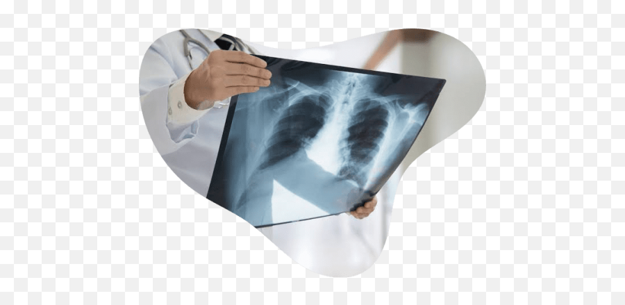 Digital X - Ray Imaging Life Medical Imaging Central Coast Xray Png,X Ray Png