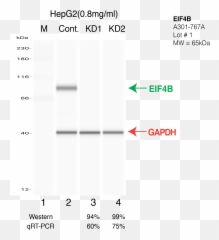 Encab697pts - Vertical Png,Antibody Png
