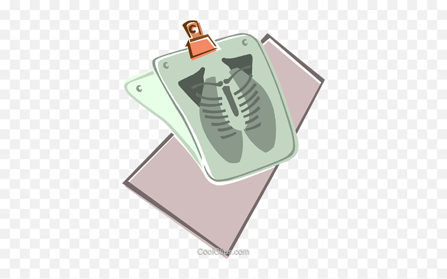 X - Ray Of The Chest Royalty Free Vector Clip Art Illustration Document Png,X Ray Png