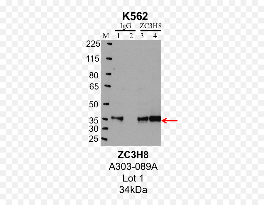 Encab192zjz U2013 Encode - Dot Png,Antibody Png