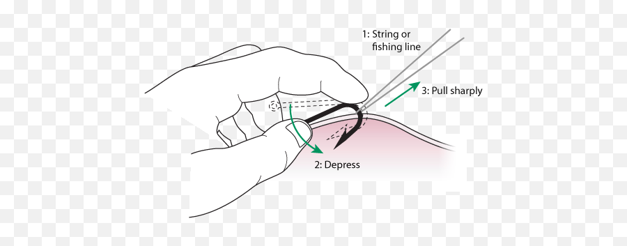 String Method - Fish Hook Removal Png,Fish Hook Icon