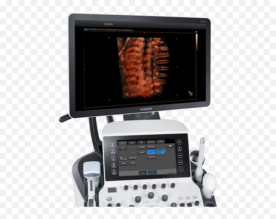 Ultrasound System Ws80a With Elite - Samsung Ws 80 A Elite Png,Ultrasound Machine Icon