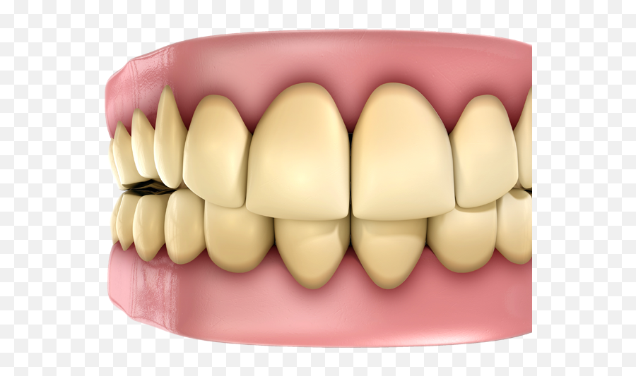Stained Teeth - Color Are Healthy Teeth Png,Teeth Png