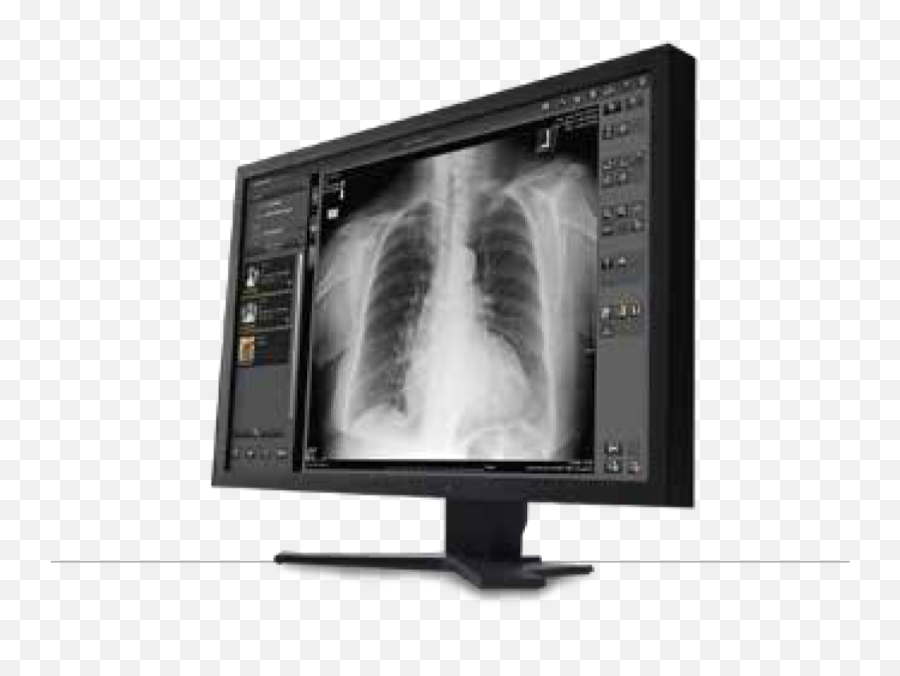 Mobile Radiography Systems Radtech X - Ray Inc Vassar Mi Lcd Display Png,X Ray Png