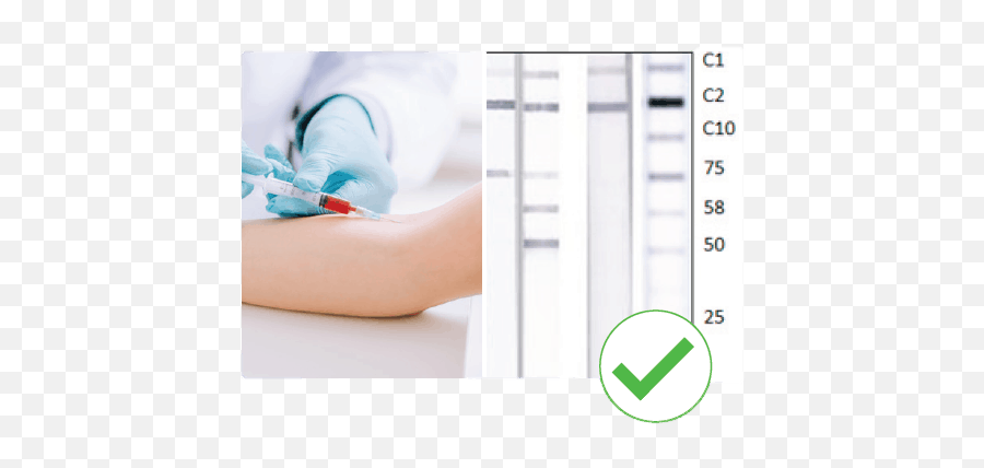 Why An Immunoblot Is A Superior Covid - Medical Procedure Png,Antibody Png