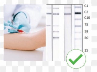 Why An Immunoblot Is A Superior Covid - Medical Procedure Png,Antibody Png
