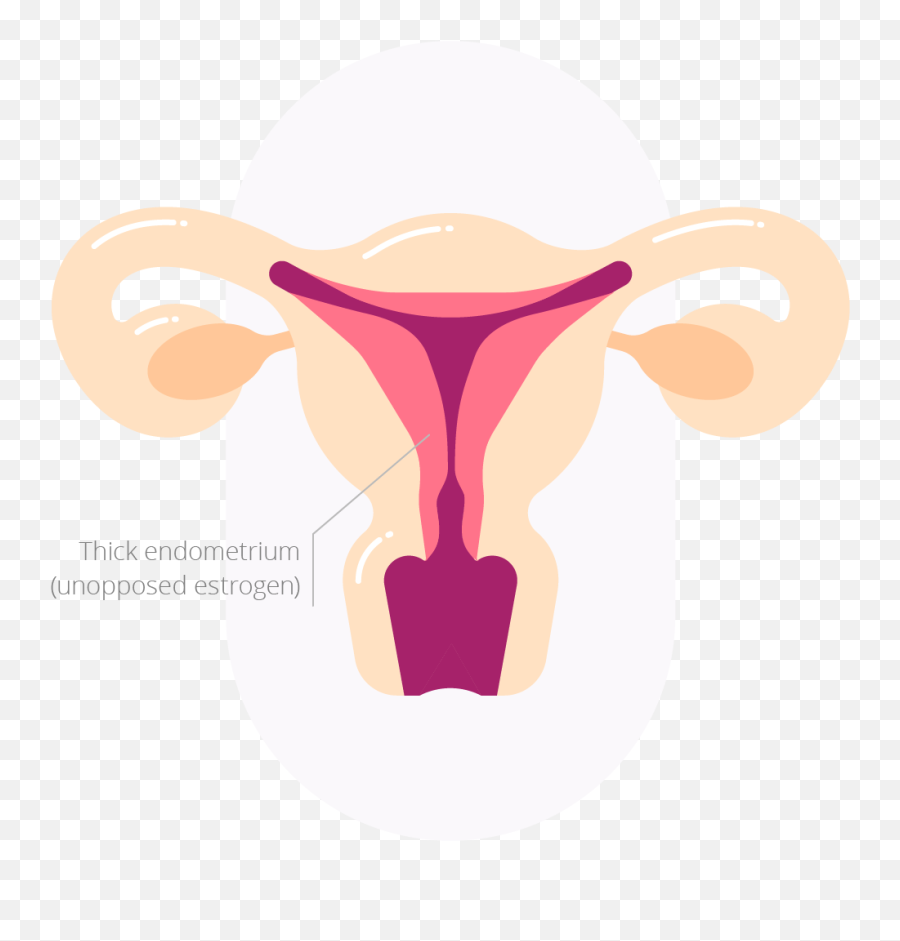 Palm - Coein Classification Ovulatory Dysfunction Palm Coein Classification Fibroid Png,Cause And Effect Icon