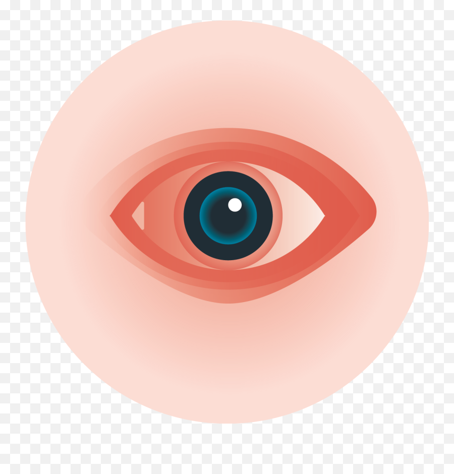 Eye Ball Png - Swollen Eye Clip Art,High Eyes Png