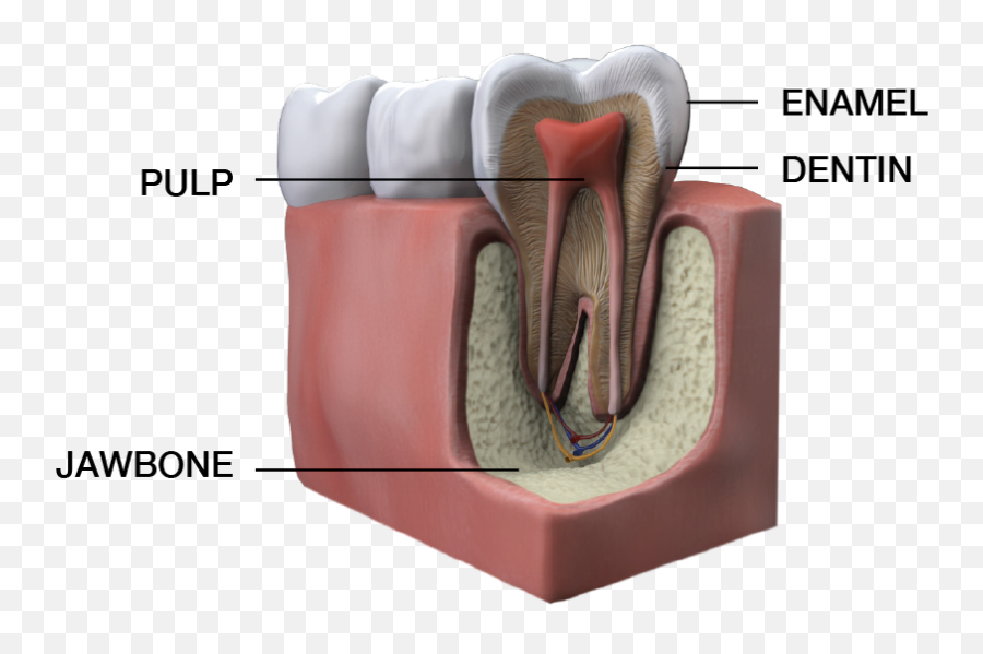 What You Need To Know About Teeth Whitening Dallas Dental - Tooth Whitening Png,Jawbone Icon Fit Kit