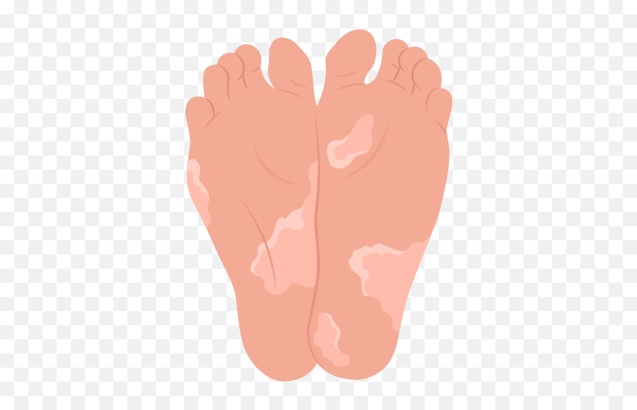 What Causes Peeling Feet Why Is The Skin - For Women Png,Washing Of The Feet Icon
