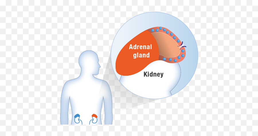 Management U0026 Treatment Cortisol Matters - For Adult Png,Adrenal Icon