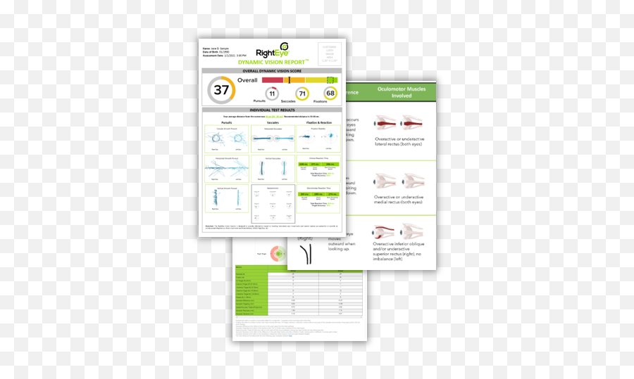 Righteye Vision System Eye - Tracking Technology Software Png,Eye Tracking Icon