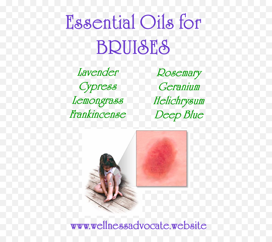 Bruises - Essential Oil For Bruise Png,Bruises Png