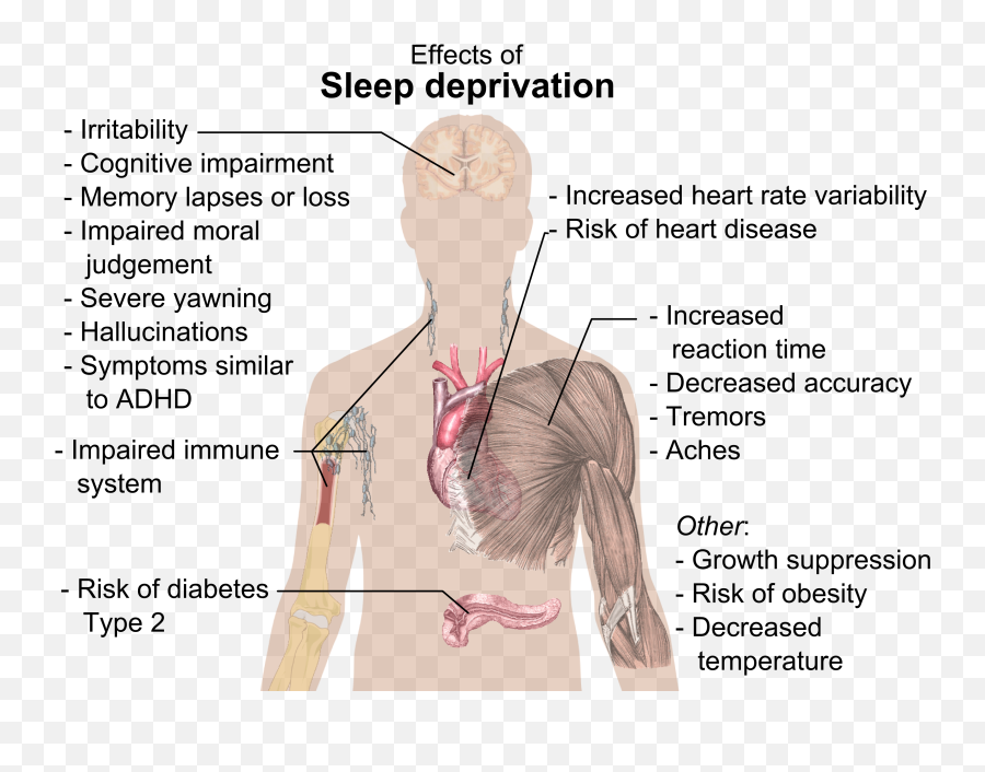 Fileeffects Of Sleep Deprivationpng - Wikimedia Commons Effects Of Sleep Deprivation,Sleeping Png