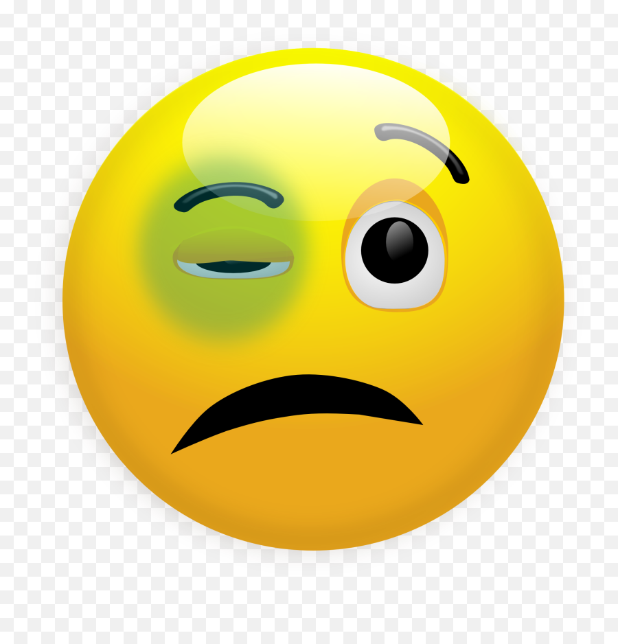 Yellow Emoticon Smiley With A Bruise - Black Eye Clip Art Png,Bruise Transparent