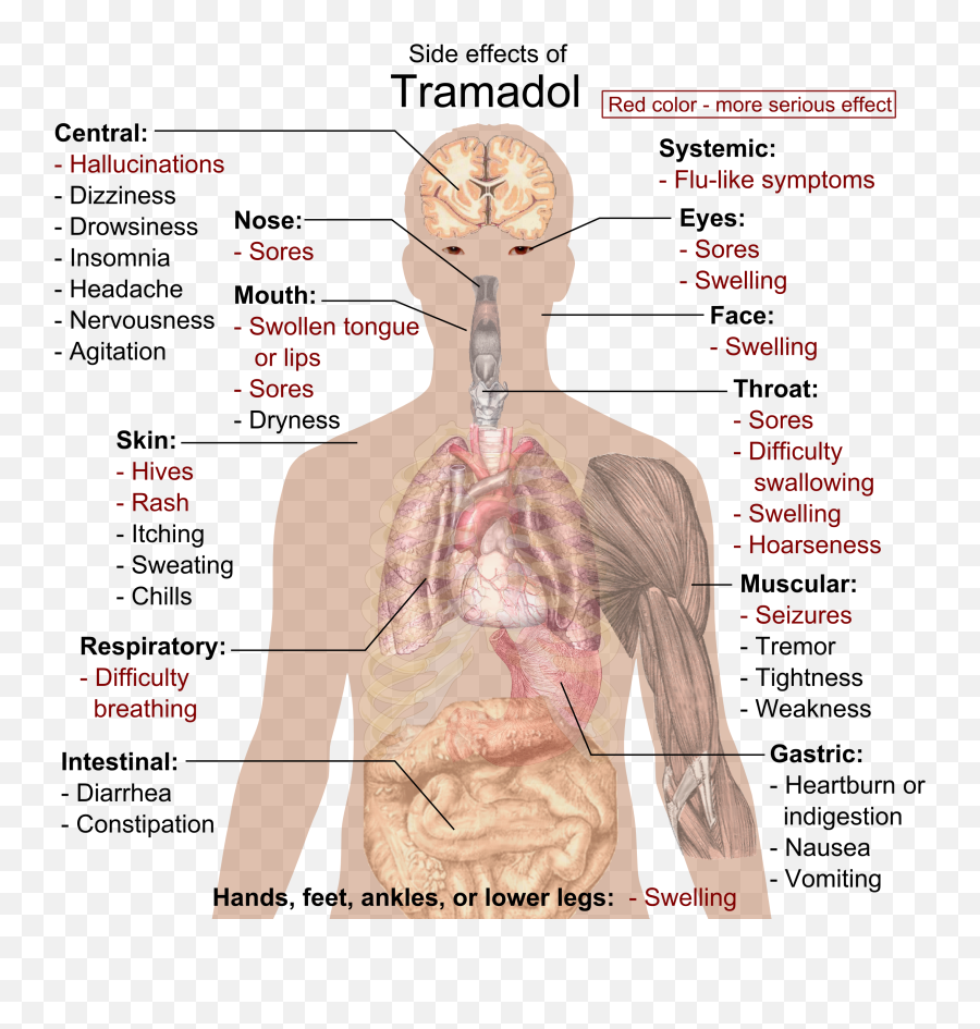 Fileside Effects Of Tramadolpng - Wikimedia Commons Signs And Symptoms Of Anaphylaxis,Red Effect Png