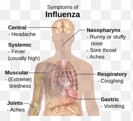 Filesymptoms Of Influenzasvg - Wikimedia Commons Clinical Feature Of Iron Deficiency Anaemia png