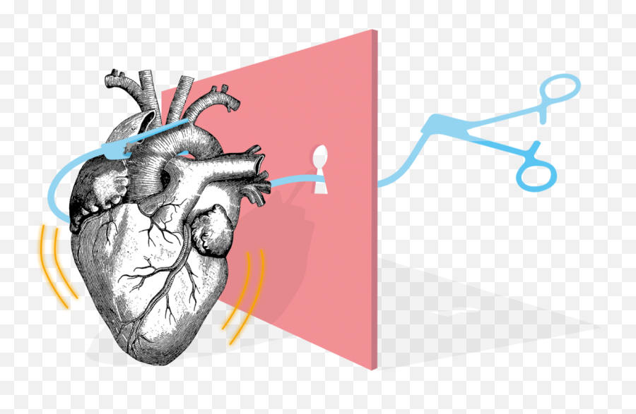 Heart Surgery - Anatomical Heart Png,Anatomical Heart Png