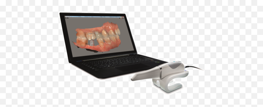 Cs 3600 For Implant Planning - Scanner Carestream 3600 Preço Png,Icon Logicon 6
