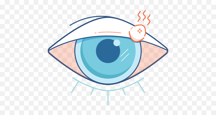 Download Red Eyes Clipart Sore Eye - Stye Cartoon Png Image Eye Stye Clip Art,Red Eyes Png