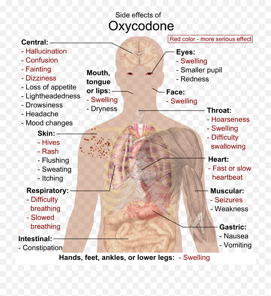 Fileside Effects Of Oxycodonepng - Wikimedia Commons Oxycodone 5mg Side Effects,Red Effect Png