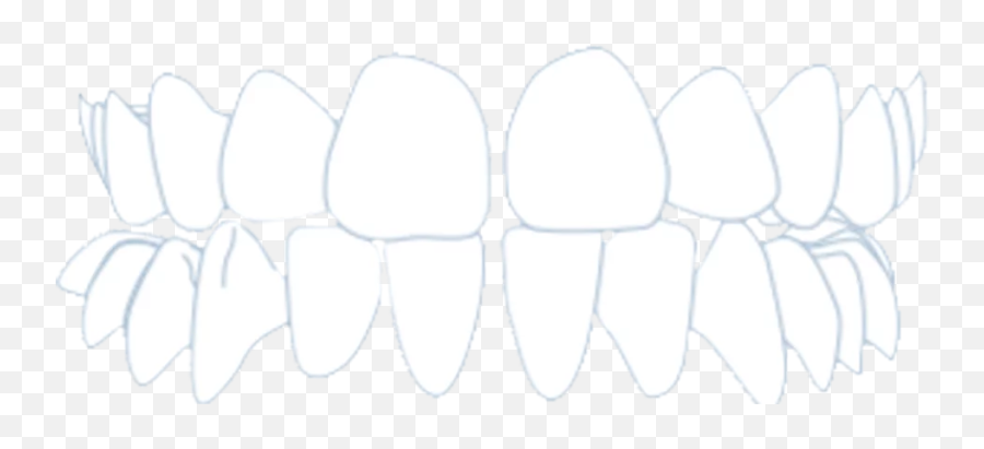 Is Inbrace Right For Me No Visible Wires Trays Just Wow - Horizontal Png,Smirk Mouth Icon