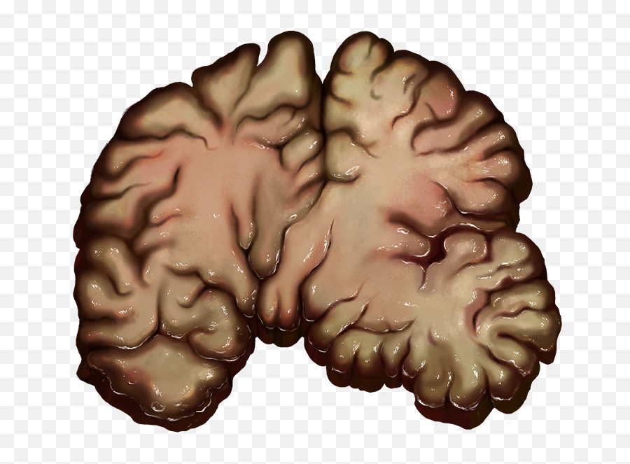 Brain - Official Pathologic Wiki Brain Png,Brain Png