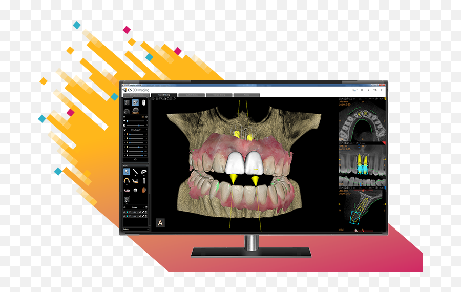 Carestream Dental Cs Imaging 8 - Language Png,Icon Logicon 6
