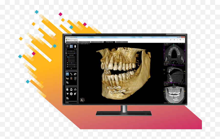 Carestream Dental Cs Imaging 8 - Language Png,Icon Logicon 6