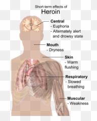 Fatality Rate For Heroin And Cocaine Users Is 14 Higher Than - Short Effects Of Heroin png