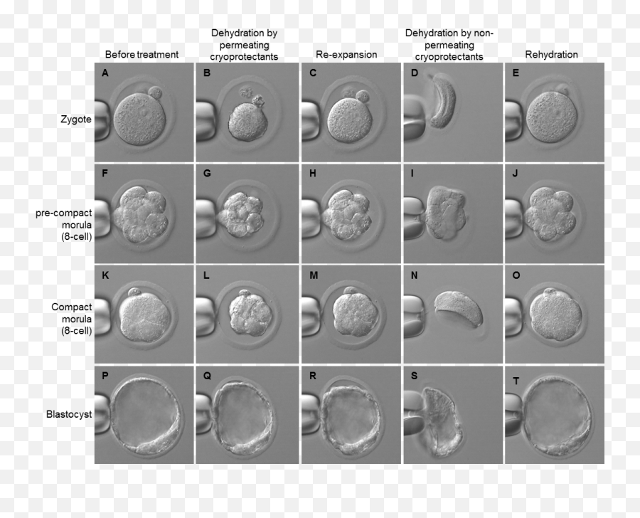 Embryo Cryopreservation - Embryo Cryopreservation Png,Embryo Png