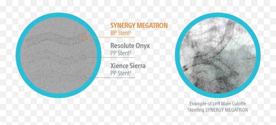 Synergy Stent System Png Megatron Icon