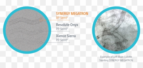 Synergy Stent System Png