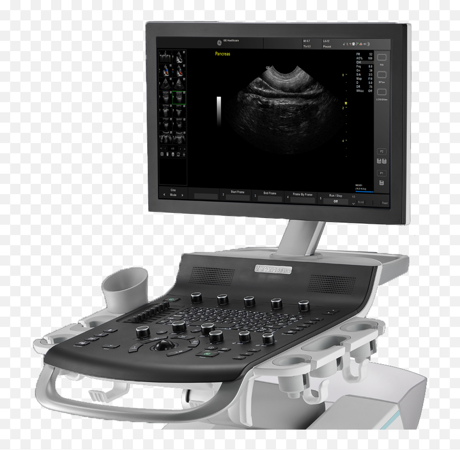 Versana Series Archives - Standard Ultrasound Ge Versana Balance Png,Ultrasound Machine Icon