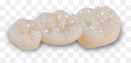 Bruxzir Esthetic Crowns Png Icon - Caries Infiltrant Proximal