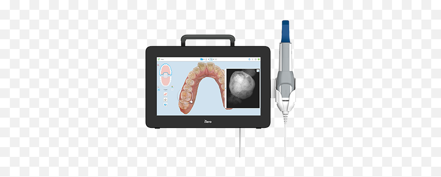 Restorative Dentistry Intraoral Digital Scanners Itero Medical Procedure Png Icon - Caries Infiltrant Proximal