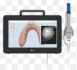 Restorative Dentistry Intraoral Digital Scanners Itero Medical Procedure Png Icon - Caries Infiltrant Proximal