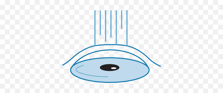 Refractive Keratectomy Or Asa - Circle Png,Laser Eyes Png