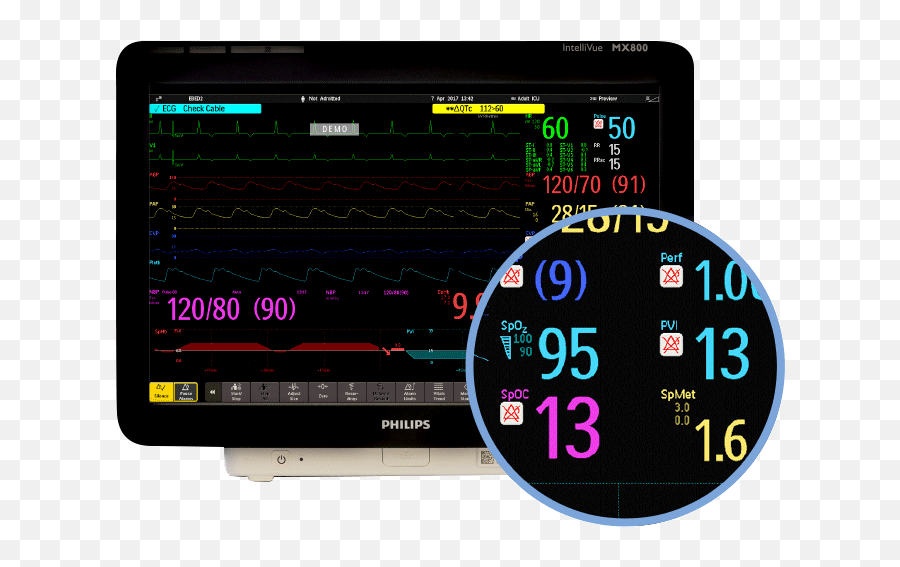 Masimo Rainbow Set Enhance Phillips Lntellivue Patient - Philips Monitor Perfusion Index Png,Google Chrome Icon Rainbow