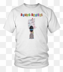 Bumps And Bruises Ugly God Shirt - 1 Blue Lives Murder T Shirt Png,Bruises Png