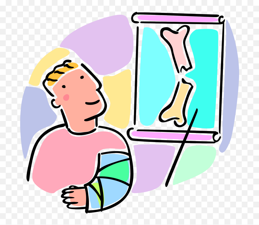 Vector Illustration Of Young Patient - Broken Bone Xray Cartoon Png,Cartoon  Arm Png - free transparent png images 