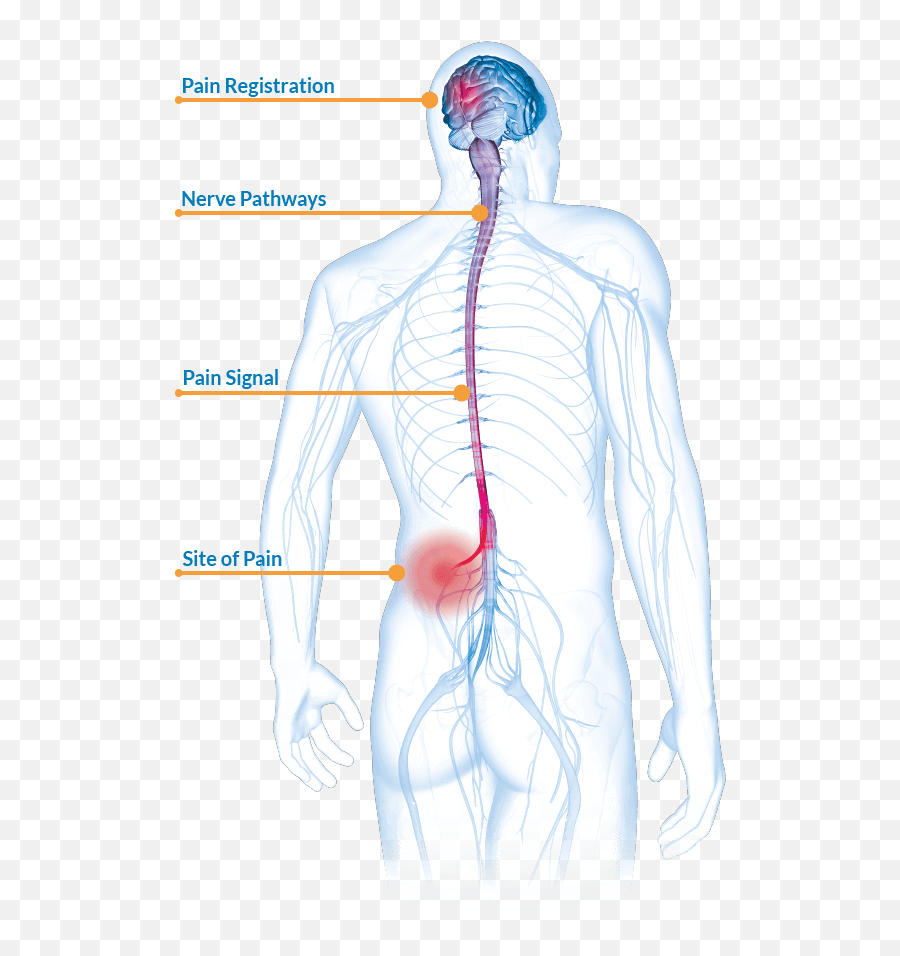 About Severe Chronic Pain Prialt Ziconotide Intrathecal - Male Png,Pain Transparent
