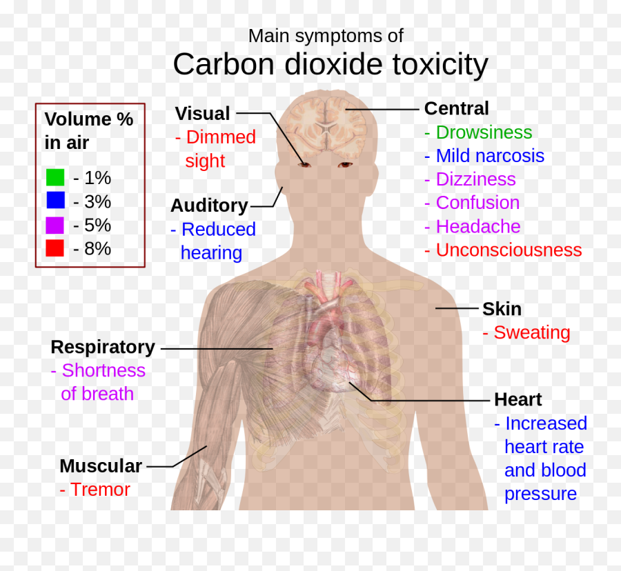 Hypercapnia - Wikipedia Carbon Dioxide Poisoning Png,Mares Icon Hd Trimix