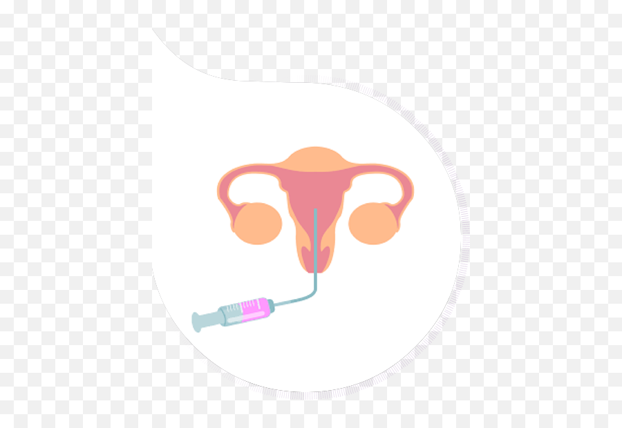 Frozen Embryo Transfer Procedure In - Frozen Embryo Transfer Icon Png,Embryo Png