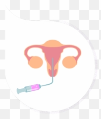 Frozen Embryo Transfer Procedure In - Frozen Embryo Transfer Icon Png,Embryo Png