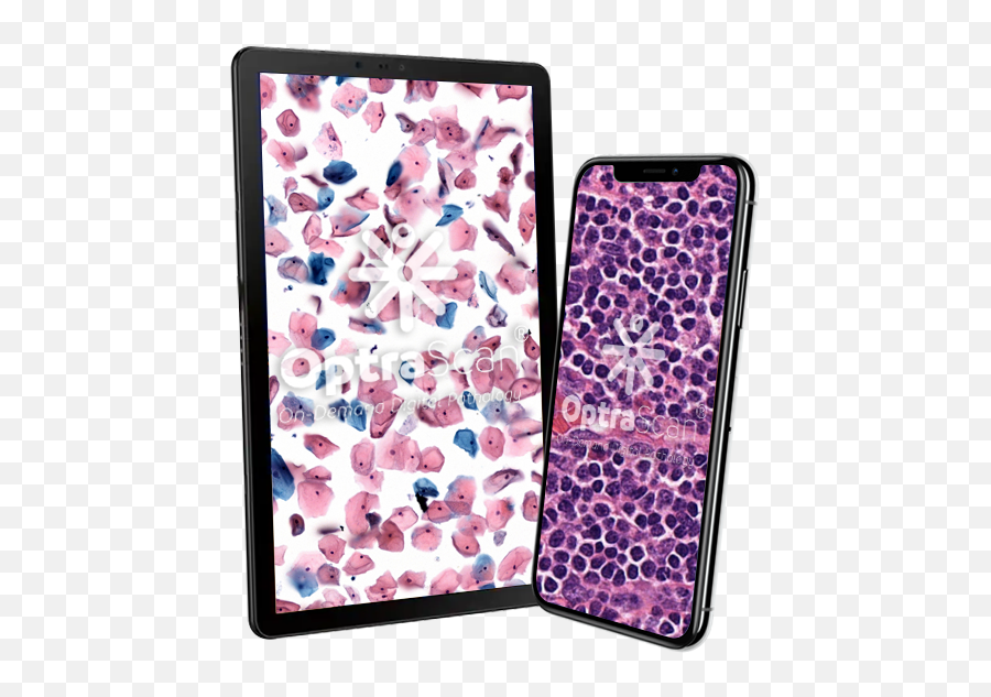 About Us Digital Pathology Solution U0026 Company - Optrascan Mobile Phone Case Png,American Icon Iphone Case