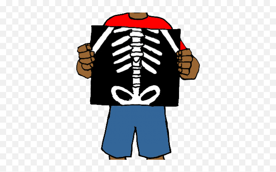 X Ray Clipart Png Transparent - Clipart Of X Ray,X Ray Png